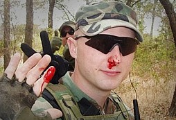 AirSoft není pro ,,dámičky" TOP 10 nejhrůznějších úrazů z AS akcí