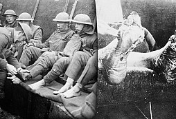 Zákopová noha: nepřítel všech armád, který stál život desítky tisíc vojáků