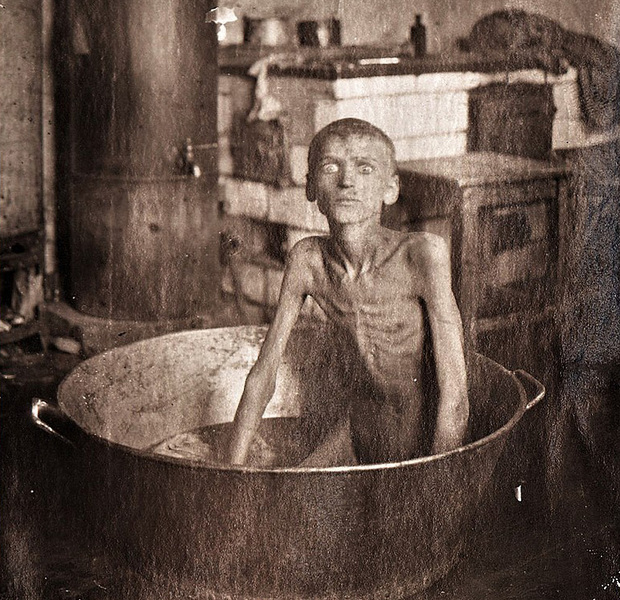 800px-A_starving_child_during_the_Famine_of_1921-22_in_Ukraine
