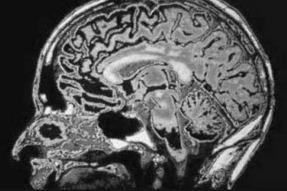 brain05